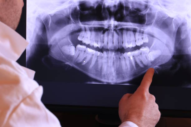 Best Emergency Gum Treatment in Jenkins, KY