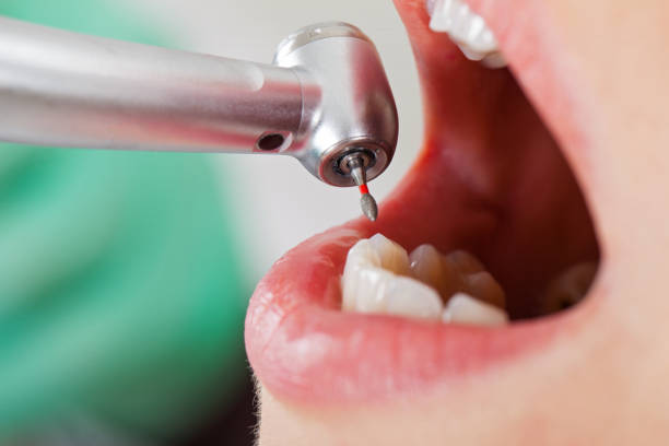 Best Emergency Tooth Extraction in Jenkins, KY